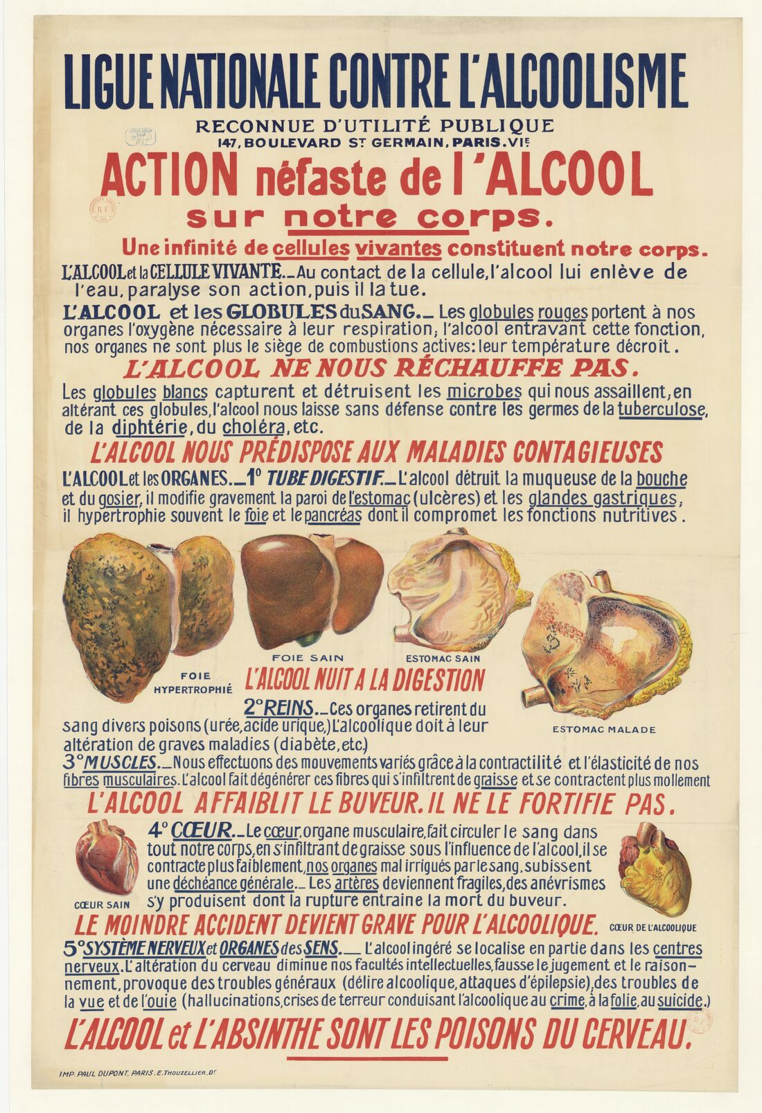 Affiche pédagogique : organes malades peints en couleurs — foie hypertrophié, estomac, cœur — entre des paragraphes en rouge et bleu ; dernière ligne : « l'alcool et l'absinthe sont les poisons du cerveau ».